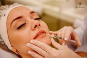 preenchimento labial com acido hialuronico na bio renew