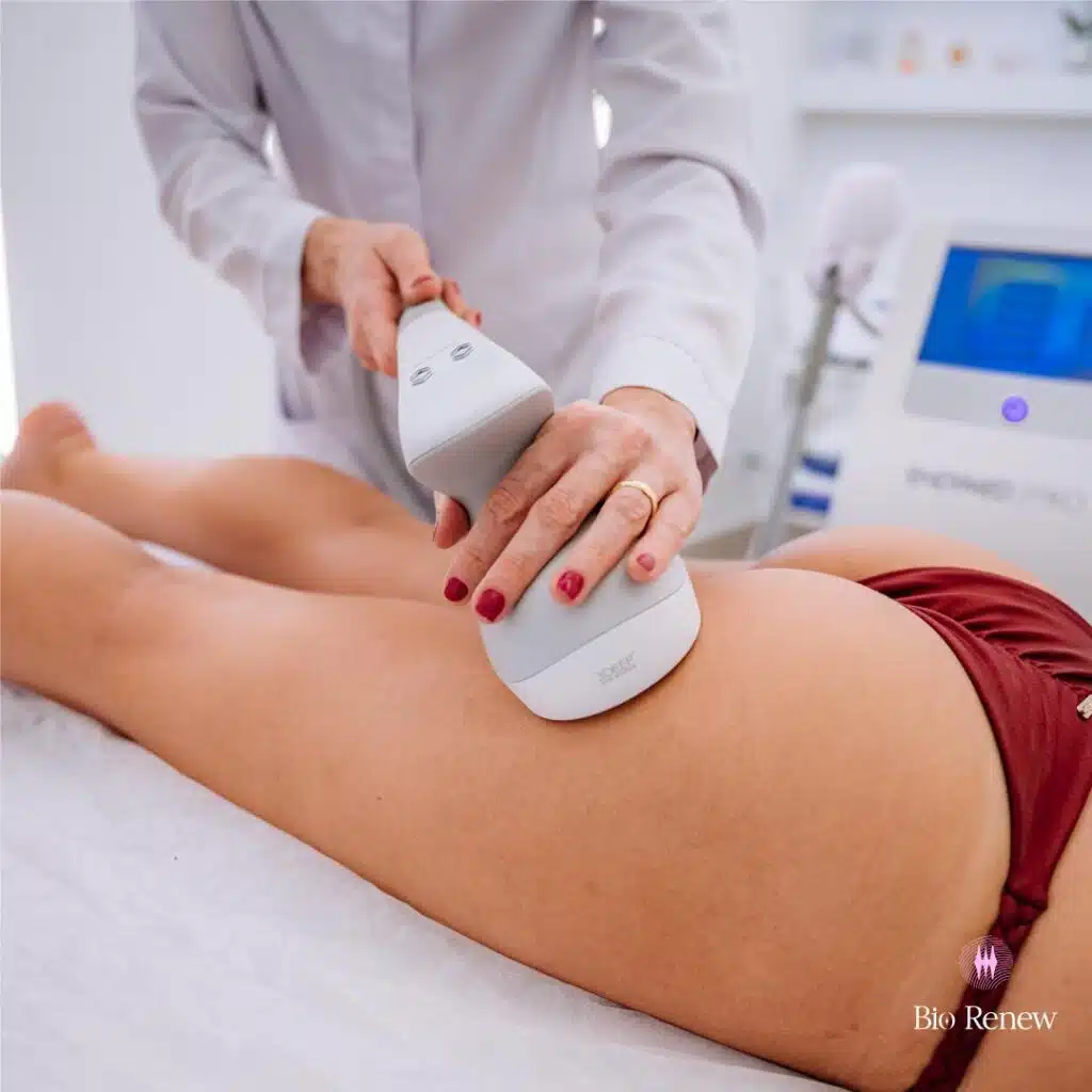 Tratamento para Celulites e Gordura Localizada - Bio Renew Clínica de Estética