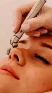 Peeling de Diamante