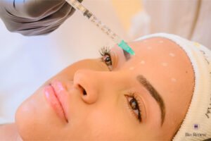 toxina botulinica em brasilia bio renew clinica de estetica