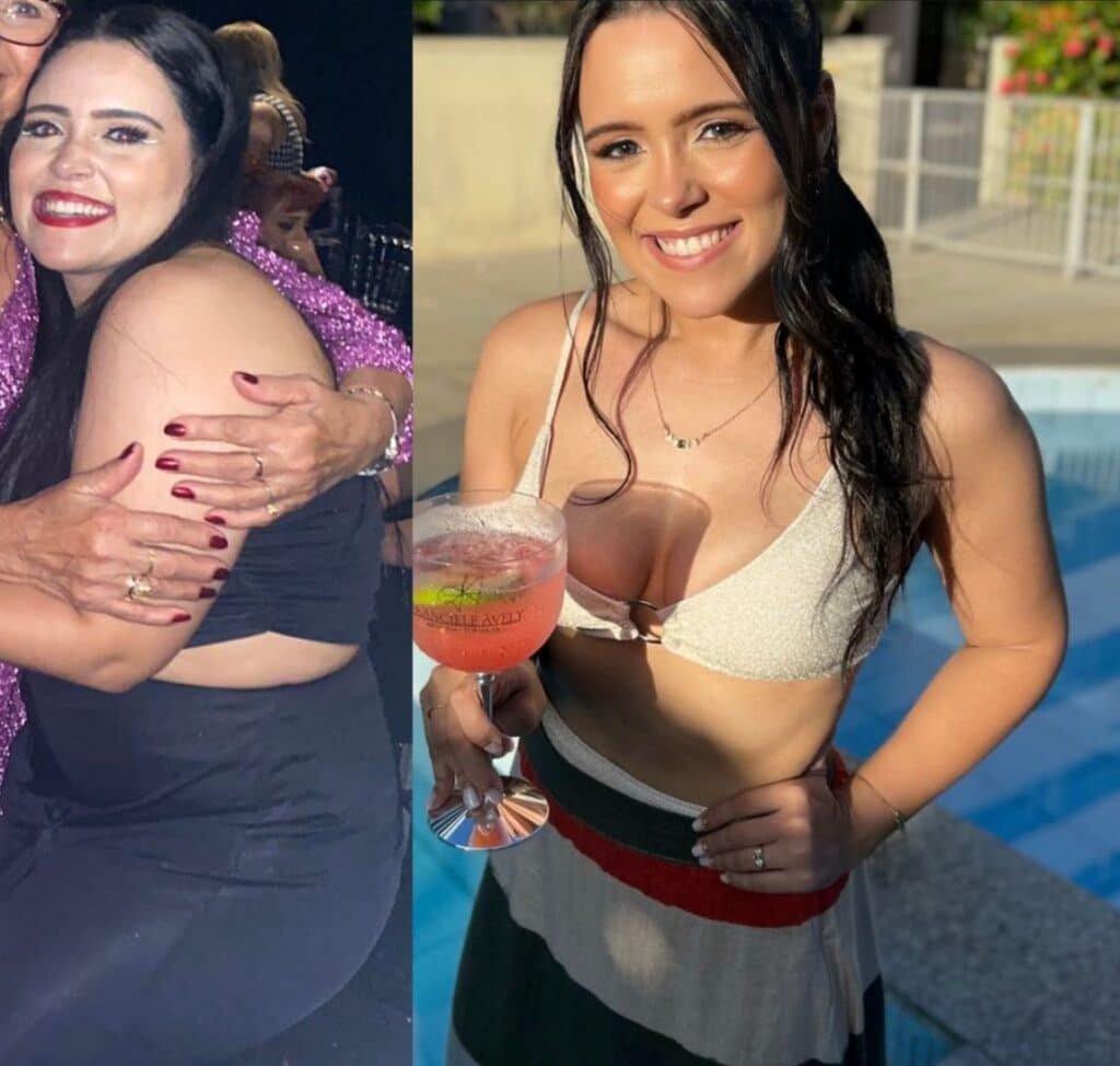 antes e depois emagrecimento ozempic - renew body